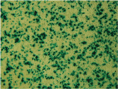 Histochemical staining of RAW 264.7 cells for β-galactosidase activity.