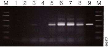Amplification of eubacterial 16S rRNA from fecal DNA extracted using the Maxwell 16 Tissue DNA Purification Kit.